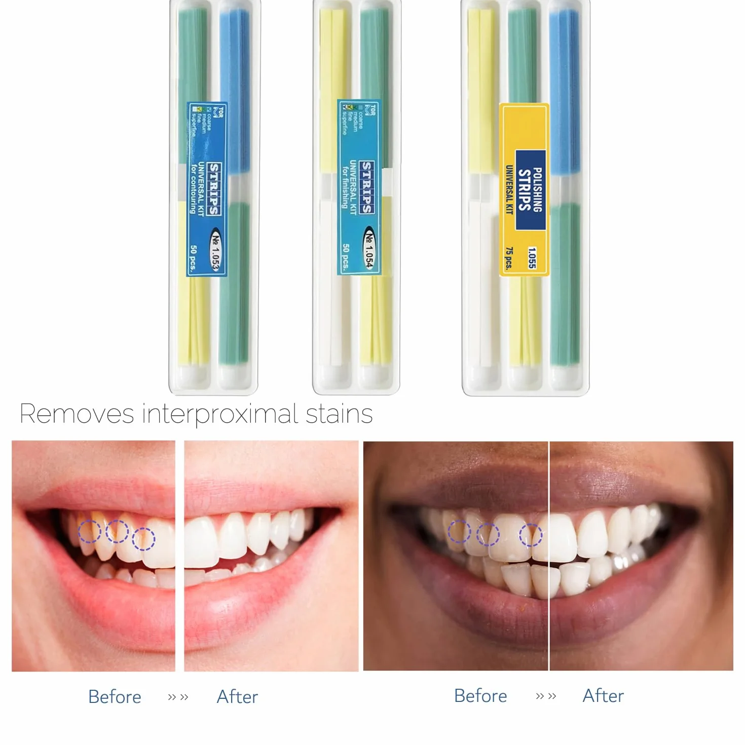 Papel de lija dental, tira de pulido dental, tamaño - 4 mm de ancho, herramienta de pulido interdental de dientes de resina NatureAqua (75 piezas/paquete)