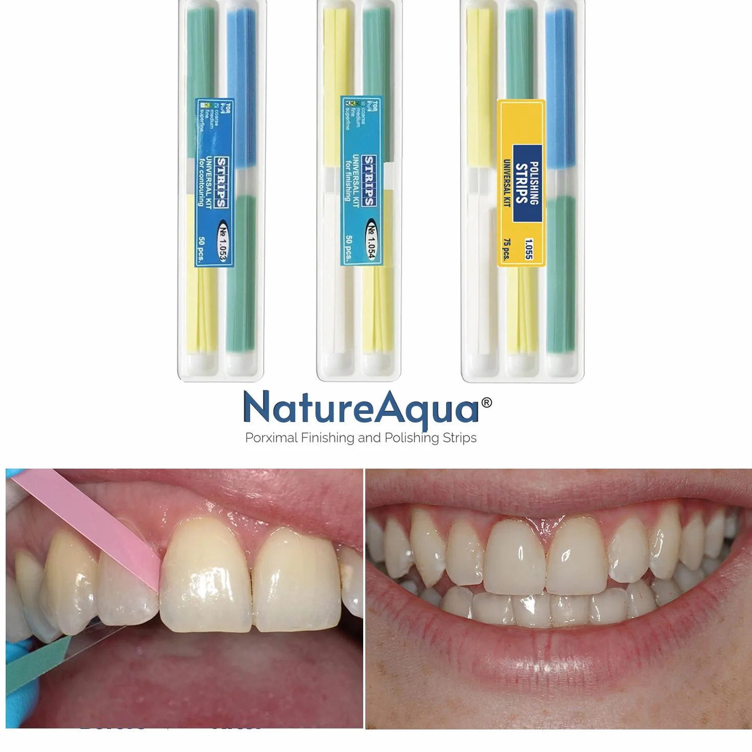Papel de lija dental, tira de pulido dental, tamaño - 4 mm de ancho, herramienta de pulido interdental de dientes de resina NatureAqua (75 piezas/paquete)